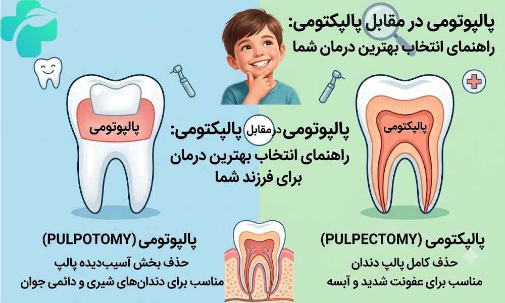 تفاوت پالپوتومی و پالپکتومی