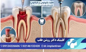 تفاوت پالپوتومی و پالپکتومی