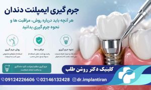 جرم گیری ایمپلنت دندان