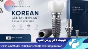 ایمپلنت کره ای