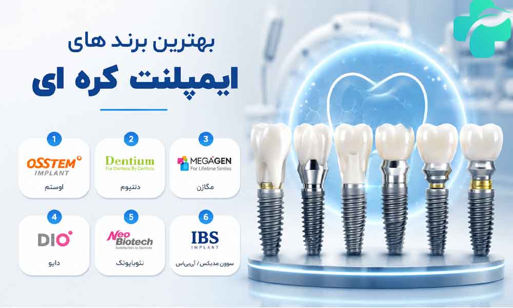 ایمپلنت کره ای