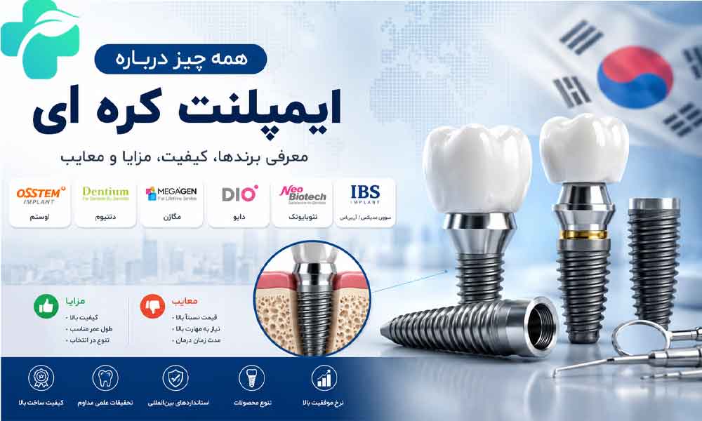 ایمپلنت کره ای