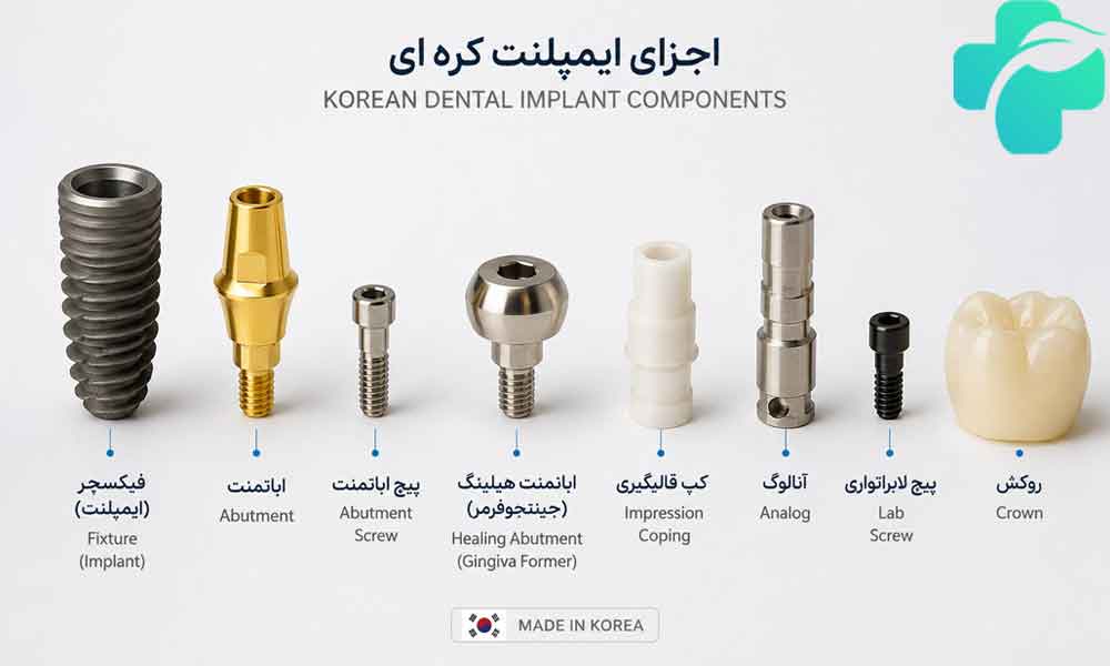 ایمپلنت کره ای
