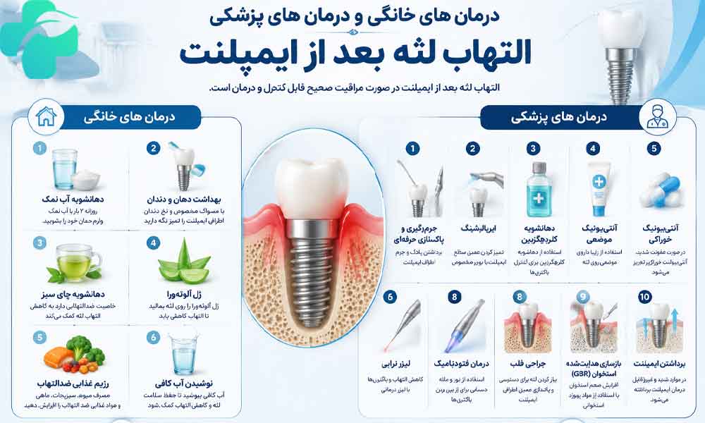 التهاب لثه بعد از ایمپلنت