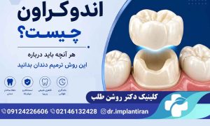 اندوکراون چیست