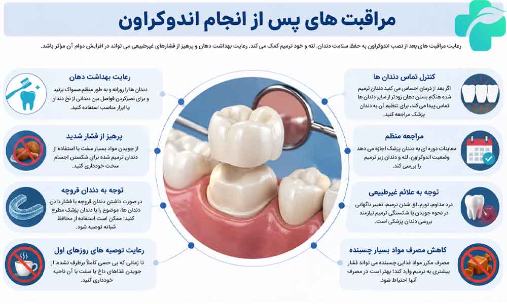اندوکراون چیست