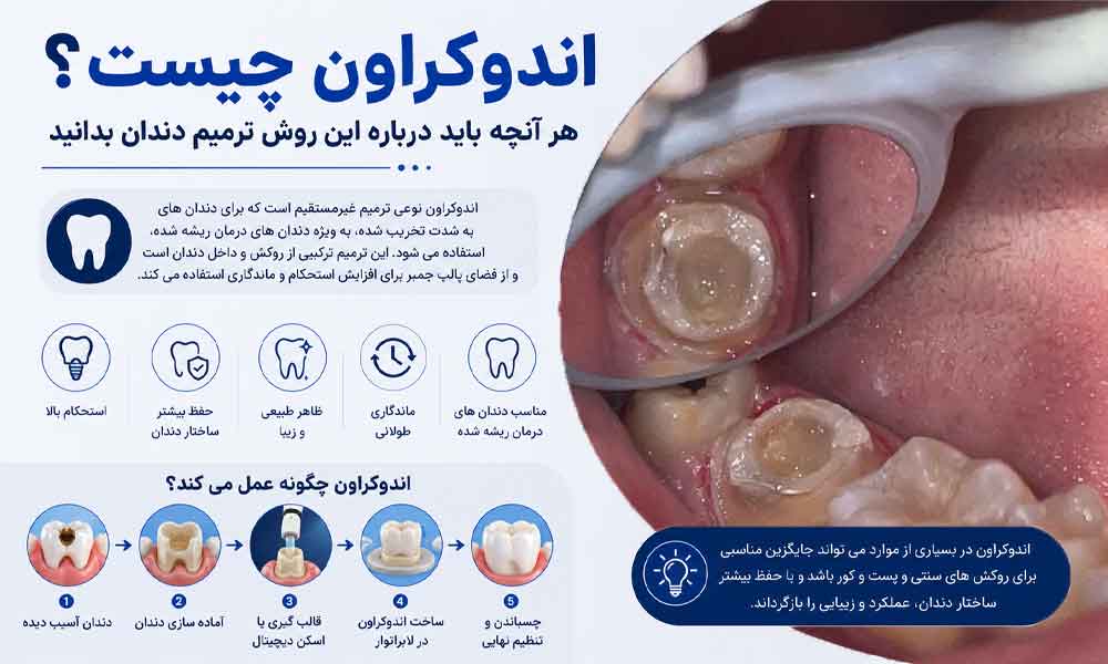 اندوکراون چیست
