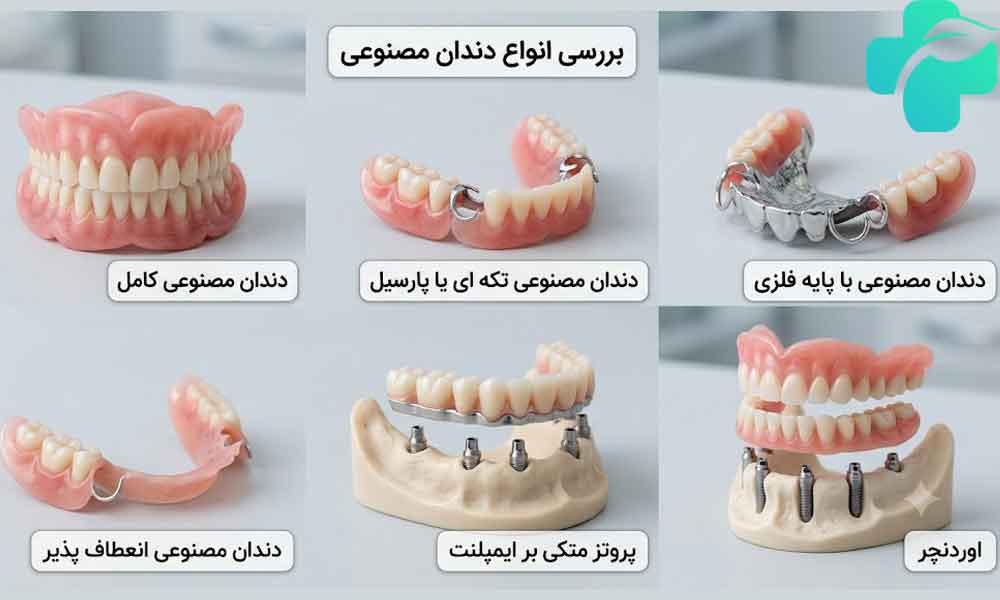 انواع دندان مصنوعی