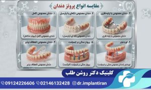 انواع دندان مصنوعی
