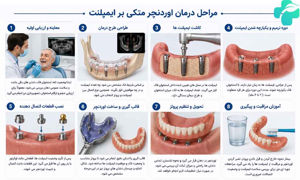 اوردنچر بر پایه ایمپلنت