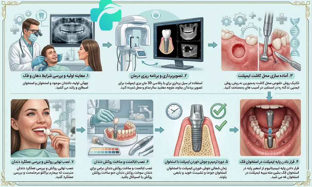 ایمپلنت پانچ چیست