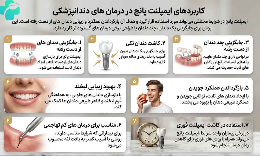 ایمپلنت پانچ چیست