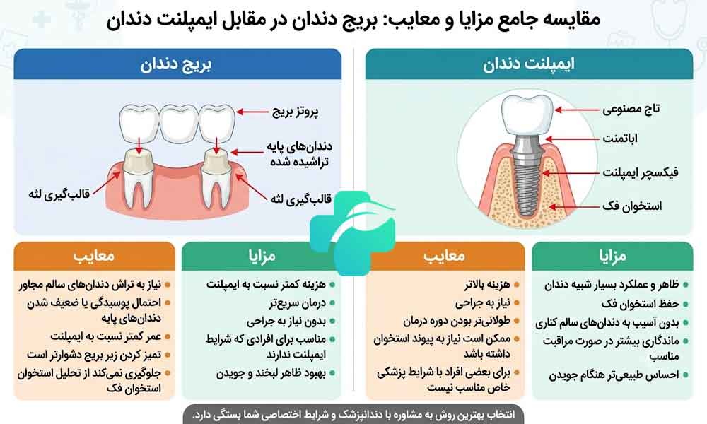 بریج یا ایمپلنت