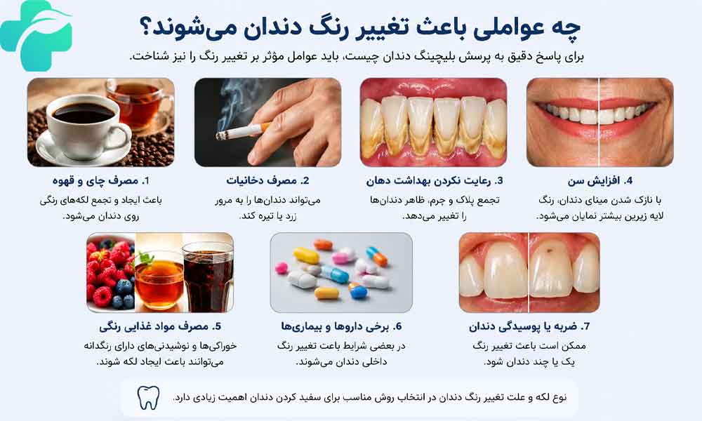بلیچینگ دندان چیست