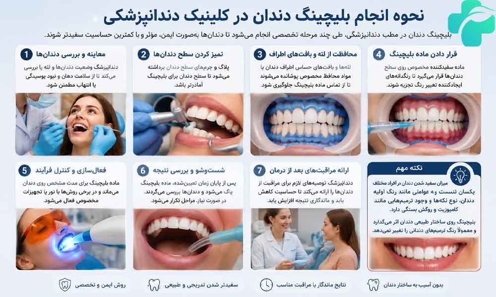 بلیچینگ دندان چیست