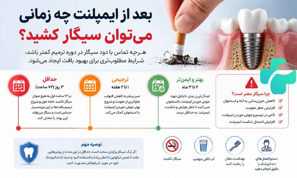 تاثیر سیگار بر ایمپلنت