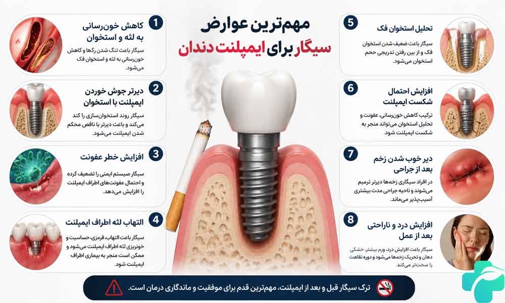 تاثیر سیگار بر ایمپلنت