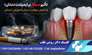 تاثیر سیگار بر ایمپلنت