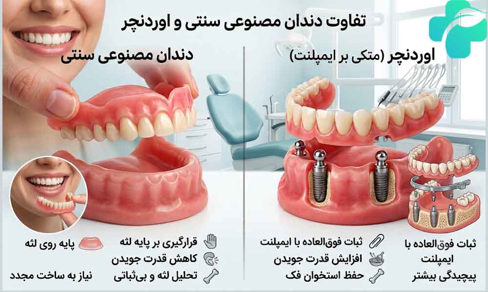 تفاوت اوردنچر و دندان مصنوعی