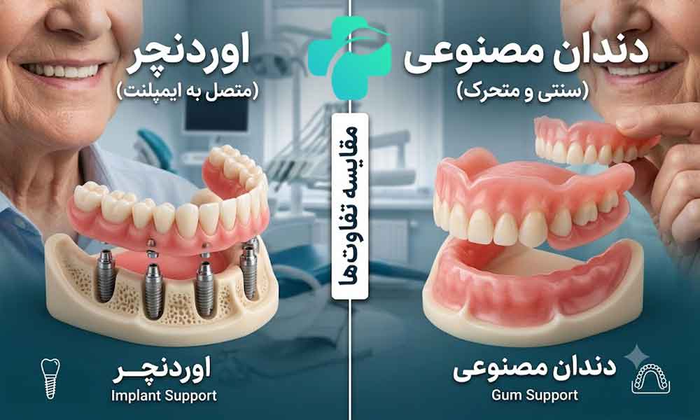 تفاوت اوردنچر و دندان مصنوعی