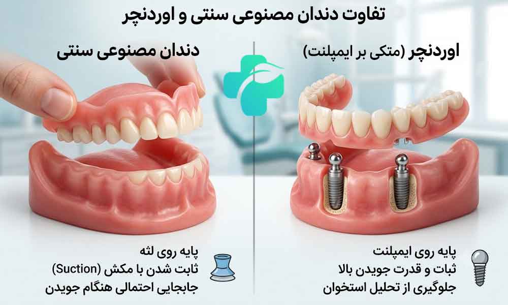 تفاوت اوردنچر و دندان مصنوعی