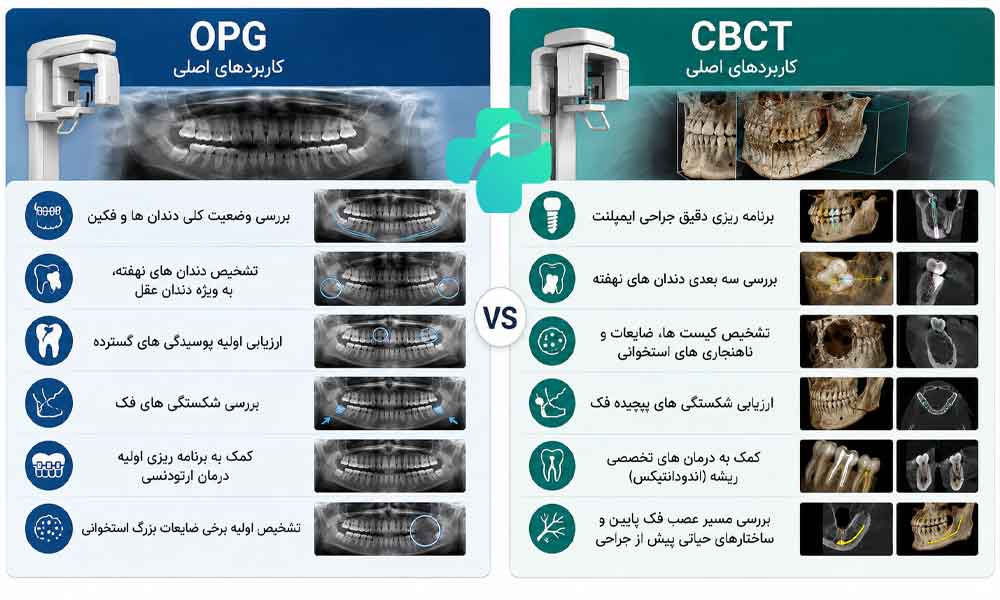 تفاوت عکس opg و cbct