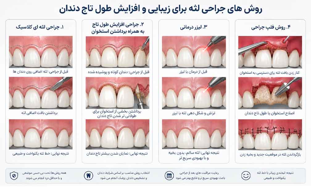 جراحی افزایش طول تاج دندان