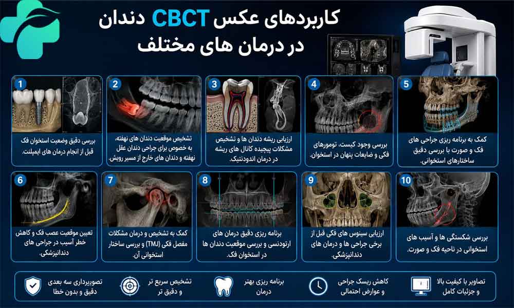 عکس cbct دندان چیست