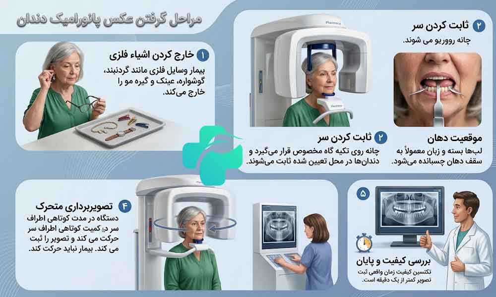 عکس OPG دندان چیست؟
