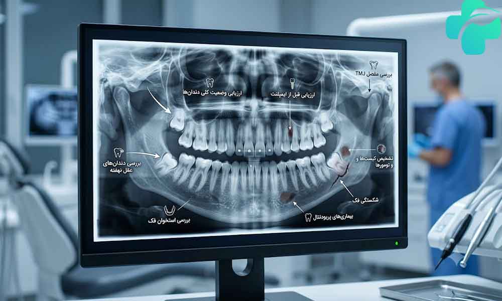 عکس OPG دندان چیست؟
