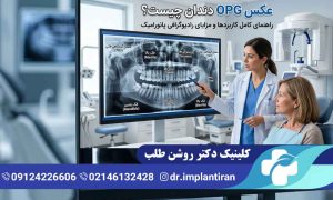 عکس OPG دندان چیست؟