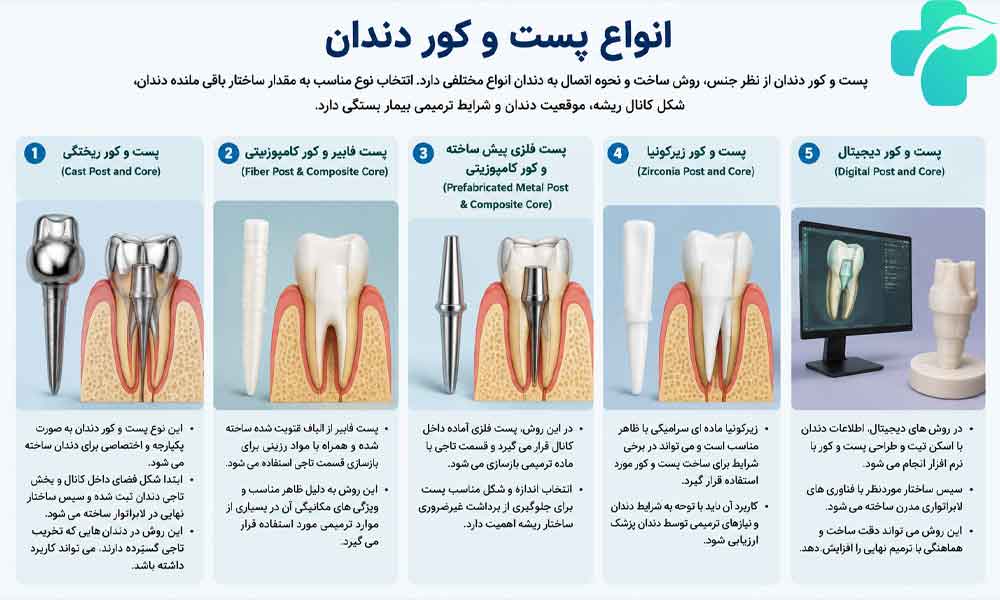 پست دندان چیست