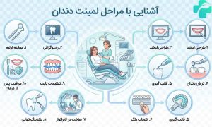 مراحل لمینت دندان