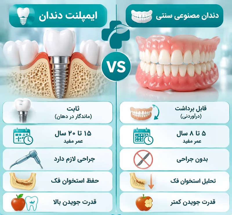 تفاوت ایمپلنت با دندان مصنوعی