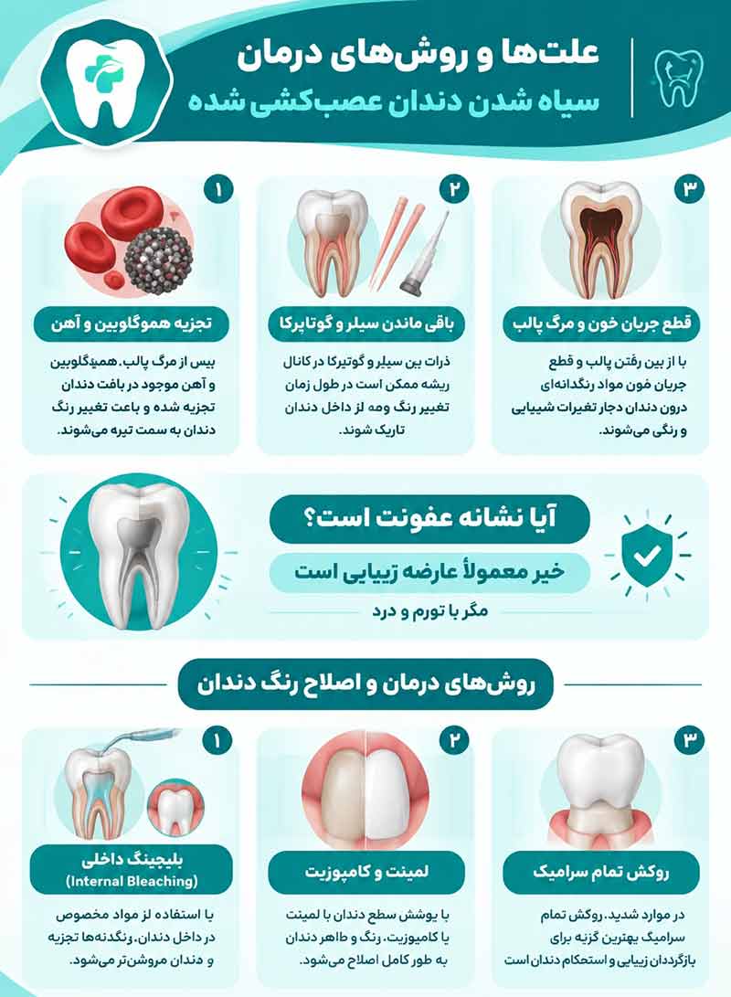 سیاه شدن دندان عصب کشی