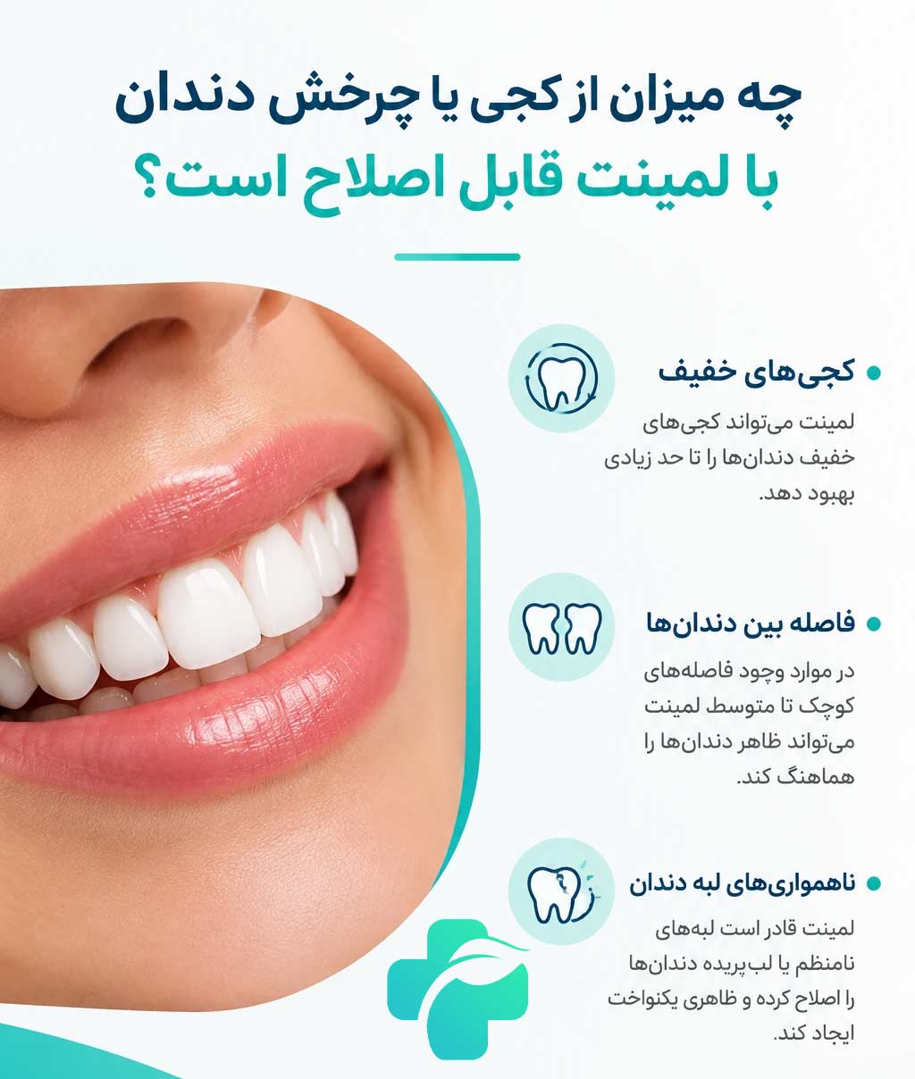 لمینت دندان کج