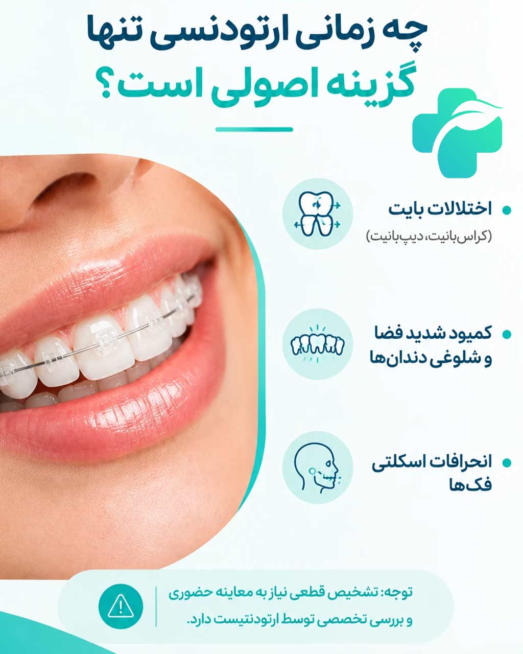 لمینت دندان کج