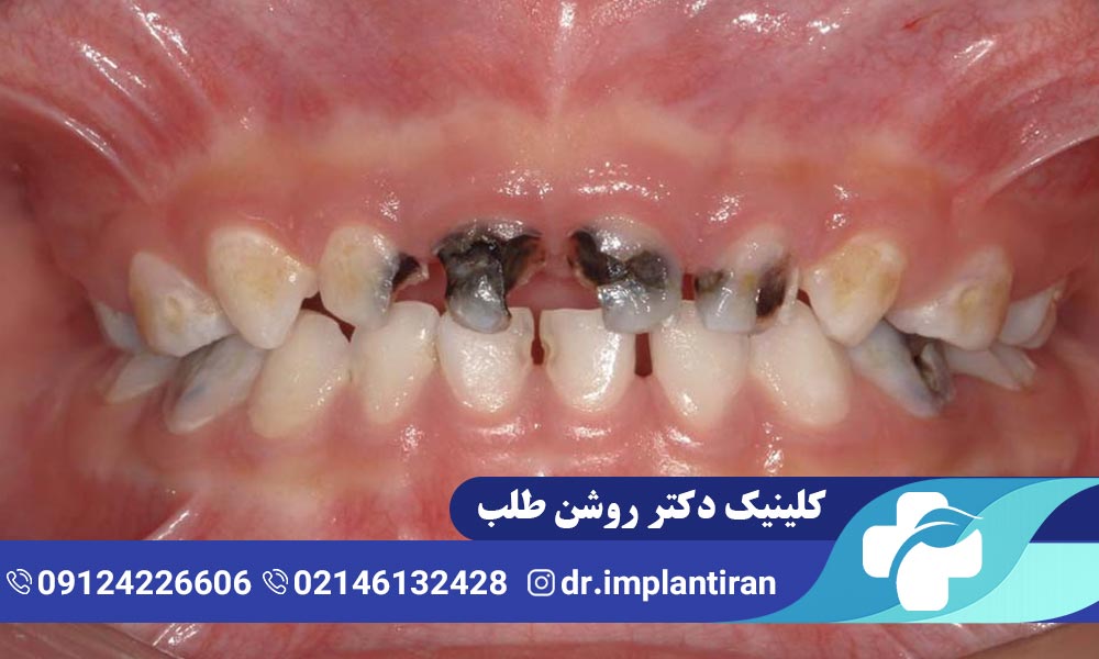 دندانپزشکی اطفال