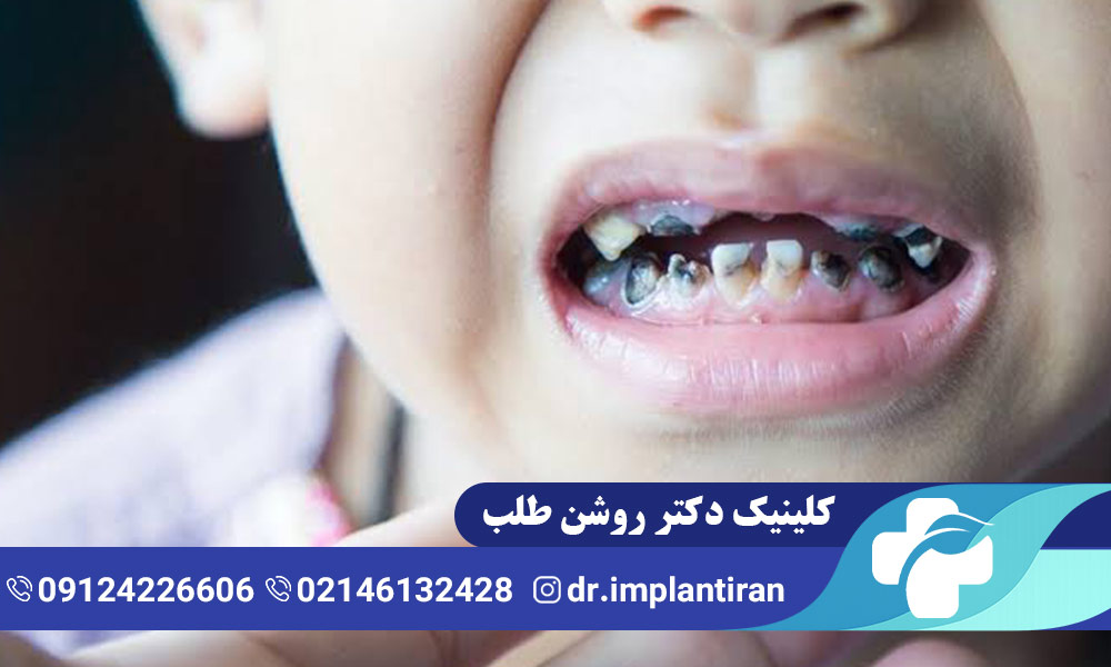 دندانپزشکی اطفال
